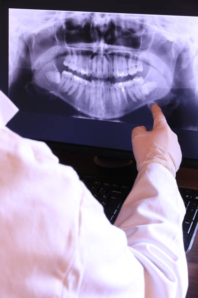 Best Emergency Dentist for Knocked-Out Tooth in Harper Woods, MI