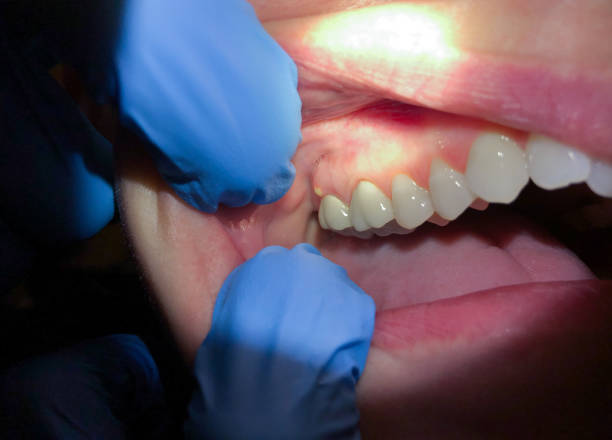 Best Mobile Emergency Dentist in Harper Woods, MI