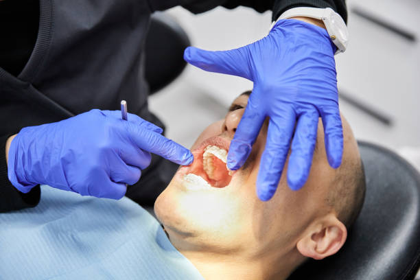 Best Emergency Dental Extractions in Harper Woods, MI